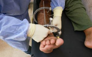  Gaza - Al Aqsa Hospital