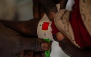 Close-up of a Mid-Upper Arm Circumference (MUAC) tape placed around a child’s arm showing severe acute malnutrition during screening at an MSF mobile clinic in Thanakuach, Jonglei State, South Sudan. 