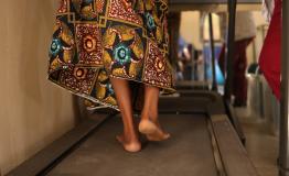  Fistula Treatment in In Jigawa State, Nigeria