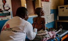 Kingsley Makwale MSF clinician examining Aisha at Mbenje Health Centre [Photo: Isabel Corthier/MSF]