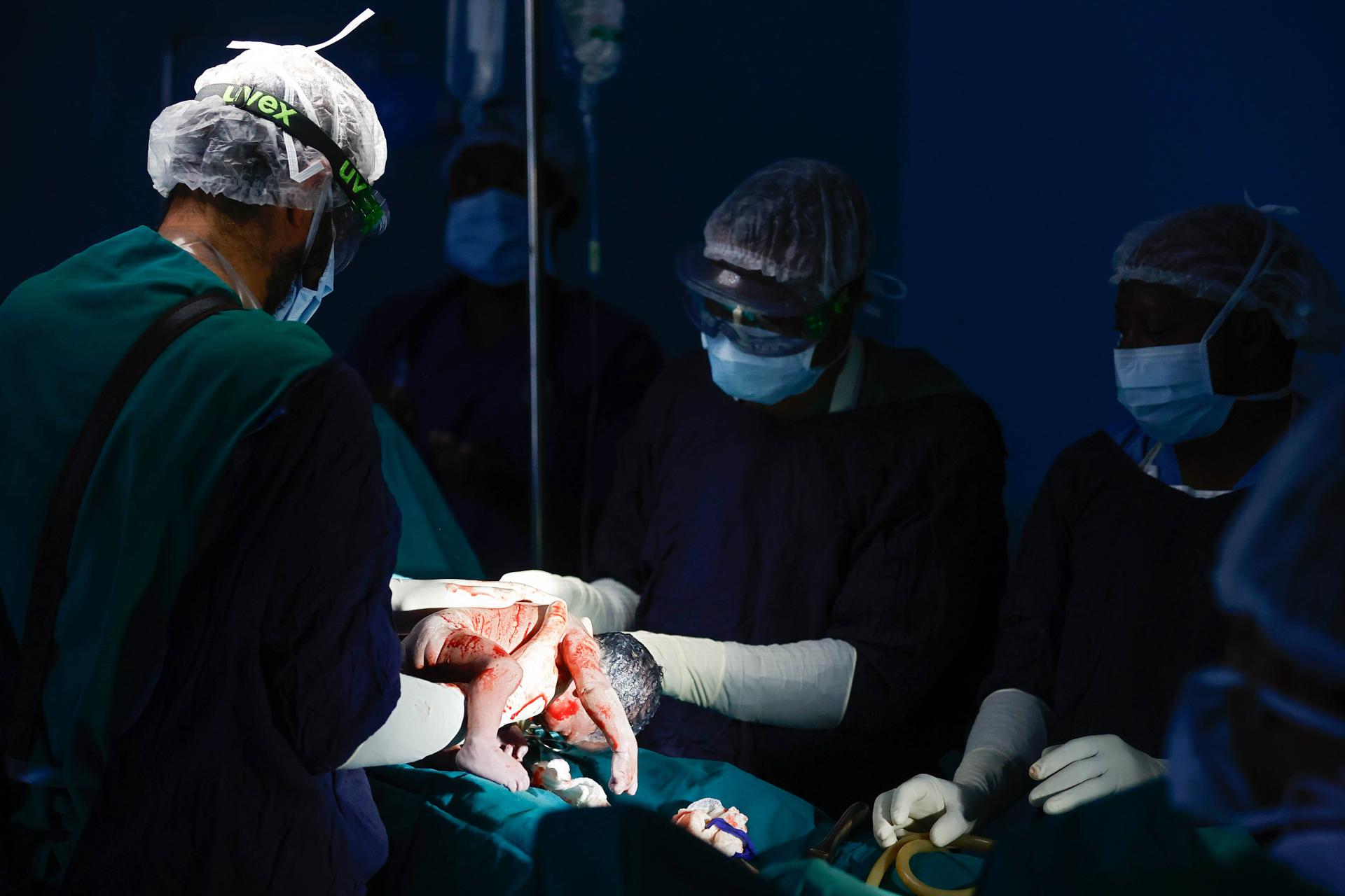 MSF medical team during a C-section in Liwali B Hospital.