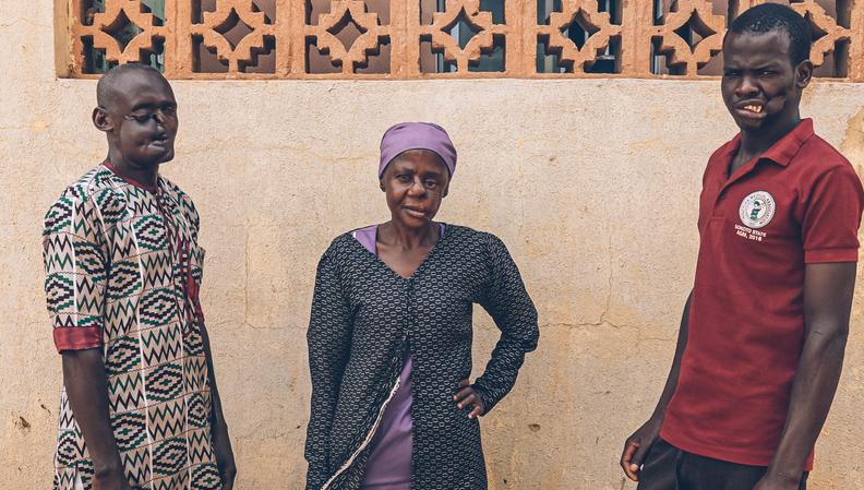 Three survivors of noma, a disease that should no longer exist