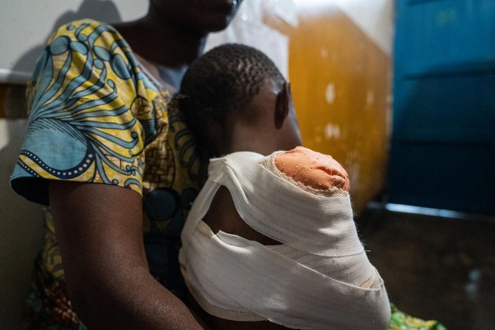 At the Mweso General Hospital, a mother holds her two-year-old daughter, injured by a bomb blast.
