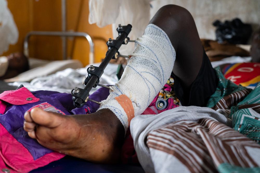 A 20-year-old gunshot victim recovers at the Mweso General Reference Hospital. He says he cannot imagine peace ever coming to the area.