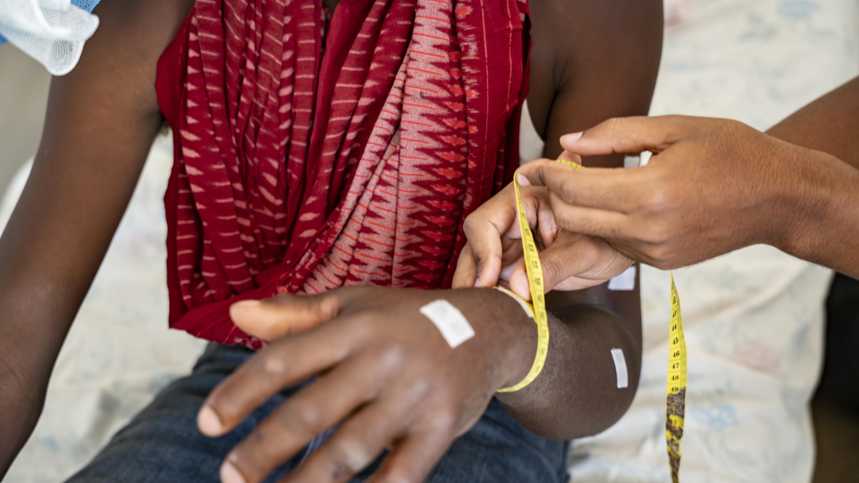 medical tea measuring the swollen arm of a snakebite patient